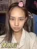 熊果苷乳膏去黑眼圈脸部去斑去除黑色素医熬夜眼霜复方男女士 1盒烟酰胺+熊果苷【组合装】 实拍图