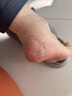 KOOGIS牛油果凡士林手足干裂防脚裂膏脚后跟干裂开裂起硬皮足跟皲裂膏 实拍图