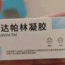999 阿达帕林凝胶0.1*21g维a酸乳膏第三代祛痘膏去闭口粉刺痤疮祛痘凝胶青春痘丘疹脓疱痘印坑修复暗疮药膏,去粉刺,寻常型痤疮,轻中度寻常型痤疮,毛囊炎 实拍图