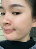 维特丝愈创木祛痘精华淡化痘印去痘痘收毛孔男女士护肤品青春期学生专用 实拍图