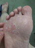 [嘉效]醋酸曲安奈德益康唑乳膏 去脚气药止痒脱皮烂脚丫真菌感染药膏根痒治脚臭脚气专用药(发货特效) 醋酸曲安奈德益康唑乳膏1盒+盐酸特比萘芬喷雾剂1瓶 实拍图