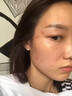 维特丝愈创木祛痘精华淡化痘印去痘痘收毛孔男女士护肤品青春期学生专用 实拍图