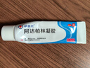 明康欣【超实惠大规格】明康欣阿达帕林凝胶30g适用于以粉刺丘疹和脓疱为主要表现的轻中度寻常型痤疮 实拍图