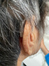 奥迪康oticon智能降噪老年人耳聋外置受话器耳背式助听器Jet1 mini双耳 实拍图