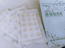 云南白药泰邦痘痘贴型创口贴 轻薄透气皮外伤擦伤贴家用创口贴 45粒*2袋 实拍图