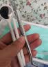 奕康本草粘牙胶水烤瓷牙粘合剂医用保丽净假牙稳固剂粘牙齿专用胶水修复凝 普通【国产材料】送基础两个工具 实拍图