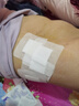 振德（ZHENDE）医用无菌敷贴 一次性大号创口贴透气伤口愈合贴 10*10cm 20片/袋 实拍图