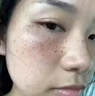 肤研祛斑霜去老年斑专用特效非药一夜消黄褐斑雀斑晒斑女男士医用的药 特效一盒【一抹祛斑】美国监制 强力祛除手部脸部淡化黑色素纯中药正品非进口 实拍图