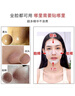 如薇（RNW）去黑头鼻贴膜5组10片免撕拉面膜导出精华液粉刺草莓鼻收缩毛孔 实拍图