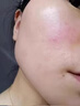 E'YEARN去增厚角质层薄高原红 红血丝舒缓过敏感肌肤面霜 一盒装 实拍图