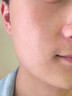 维特丝愈创木祛痘精华淡化痘印去痘痘收毛孔男女士护肤品青春期学生专用 实拍图