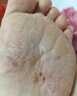 内廷上用同仁堂脚气喷雾止痒脱皮烂脚丫真菌感染脚臭狼毒除臭杀菌非药软膏 实拍图