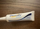 倍舒痕官方进口Dermatix舒痕硅凝胶祛疤膏淡化增生瘢痕烧术后儿童款7g 实拍图