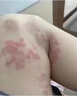 御传堂牛皮癣皮肤癣专用特强効药膏顽固银屑病抑菌止痒生物制剂 御夫灵膏6 实拍图