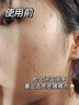韩方五谷壬二酸去黑头泥膜控油保湿收缩毛孔面膜深层清洁祛痘粉刺金榜 实拍图