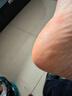 [福元]硝酸咪康唑乳膏 脚气药止痒脱皮烂脚丫真菌感染根药治脚脱皮抗真菌干裂脱皮脚后跟干裂膏角化型脚气 2%*20g 1盒装 【国药正品杀菌止痒推荐组合】 实拍图