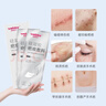 维德（WELLDAY）硅凝胶医用疤痕贴剖腹产医美术后减张贴专用修复祛疤贴2X12cm*2片 实拍图