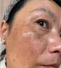 肤研祛斑霜去老年斑专用特效非药一夜消黄褐斑雀斑晒斑女男士医用的药 特效一盒【一夜消】日本进口 强力祛除手部脸部淡化黑色素纯中药正品进口 实拍图
