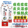牛皮癣白癣皮软膏股癣大腿内侧阴囊私处瘙痒花斑癣荨麻手足癣真菌感染止痒膏皮肤瘙痒皮炎湿疹鹅掌风干裂脱皮 顽藓净抑菌膏 【20g/盒】 实拍图
