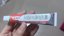 原研药】达克宁硝酸咪康唑乳膏20g脚气药止痒脱皮烂脚丫真菌感染自营软膏脚臭专用药灰指甲硝酸咪康唑散粉 实拍图