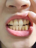 韩方五谷炫白牙齿亮白牙贴去黄洁白美牙一次性贴片温和不酸急救大白牙洁牙 实拍图