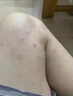 御传堂牛皮癣皮肤癣专用特强効药膏顽固银屑病抑菌止痒生物制剂 御夫灵膏6 实拍图