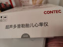 CONTEC康泰多普勒胎心仪胎心监测仪家用胎心监护仪 孕妇家用Sonoline A 实拍图