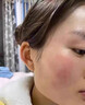 E'YEARN去增厚角质层薄高原红 红血丝舒缓过敏感肌肤面霜 一盒装 实拍图