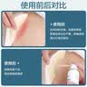 可孚医用造口袋腹带造瘘口术后专用固定器防疝气旁疝弹力腰带 XL码 实拍图