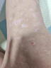 御传堂牛皮癣皮肤癣专用特强効药膏顽固银屑病抑菌止痒生物制剂 御夫灵2送1 实拍图