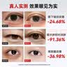 歐泉琳美眼仪眼部按摩仪提拉紧致眼袋去除仪器消肿去黑眼圈眼部美容仪送女友礼物 实拍图