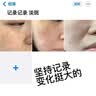 DR.NEUER熊果苷乳膏去黑色素烟酰胺祛斑霜雀斑晒斑提亮减黄改善暗沉女2支 实拍图