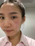 美颜坊B5修复面霜红血丝角质层薄皮肤屏障受损泛红增厚敏感肌保湿专用 实拍图