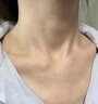同仁堂后背痘痘药膏后背长痘痘毛囊炎专用前胸后背部脓包除螨祛痘喷雾剂 一盒装【多买多送】发货特效快 实拍图