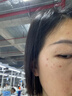 北京同仁堂点痣疤痕修复点痣结痂脱落修复凝胶激光术后去红印黑印修复液医用 点痣疤痕修复结痂脱落修复凝胶 实拍图