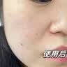 DR.NEUER熊果苷乳膏去黑色素烟酰胺祛斑霜雀斑晒斑提亮减黄改善暗沉女2支 实拍图