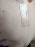 美皮护疤痕贴硅酮祛疤瑞典【双眼皮】2.5X10cm【全网低价】 实拍图