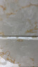 Abtei德国静脉软膏曲张专用七叶树植萃蚯蚓腿红血丝淤青堵塞站坐肿酸胀 德国进口125ml*1支（3支/疗程） 实拍图