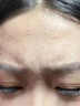 维特丝愈创木祛痘精华淡化痘印去痘痘收毛孔男女士护肤品青春期学生专用 实拍图