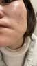 德康凯琳医学护肤修护产品械字号护肤品修复屏障受损医用水乳保湿补水套装 医用修复5件套 药房械字号护肤品修复屏障受损官方正品 实拍图