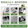 云南白药茶树油4松油醇眼部清洁湿巾眼睛眼部杀螨虫除螨湿巾眼痒 20片/盒 实拍图
