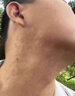 [拜都帮]曲安奈德益康唑乳膏 汗斑花斑癣专用药汗斑专用药(发货特效)真菌感染皮肤用药皮肤白斑汗斑净 15g 1支装 【真菌感染】 实拍图