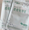 云南白药泰邦痘痘贴型创口贴 轻薄透气皮外伤擦伤贴家用创口贴 45粒*2袋 实拍图