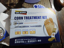 DR.SOKK鸡眼贴鸡眼膏去根肉刺药膏去无痛脱落连根拔跖疣脚底趾疣去根膏贴 实拍图