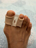 康德昂拇指外翻矫正器脚趾分离器大拇指脚指头大脚骨突出分趾器男女医用 实拍图