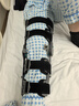 麦德威（medwe）医用膝关节固定支具碳纤维膝盖支架腿部骨折韧带术后护具MD177-14 实拍图