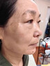肤研祛斑霜去老年斑专用特效非药一夜消黄褐斑雀斑晒斑女男士医用的药 特效一盒【一夜消】日本进口 强力祛除手部脸部淡化黑色素纯中药正品进口 实拍图