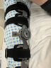 麦德威（medwe）医用膝关节固定支具碳纤维膝盖支架腿部骨折韧带术后护具MD177-14 实拍图