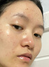 维特丝水杨酸祛痘精华淡化痘印去痘痘收毛孔男女士护肤品青春期学生专用 实拍图