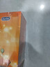 杜蕾斯（durex）避孕套安全套魔法情趣18只成人螺纹大颗粒男专用防早泄套套年货 实拍图